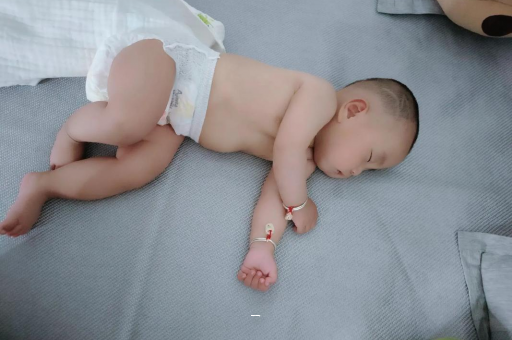 邹城宝宝脸上有白色斑块